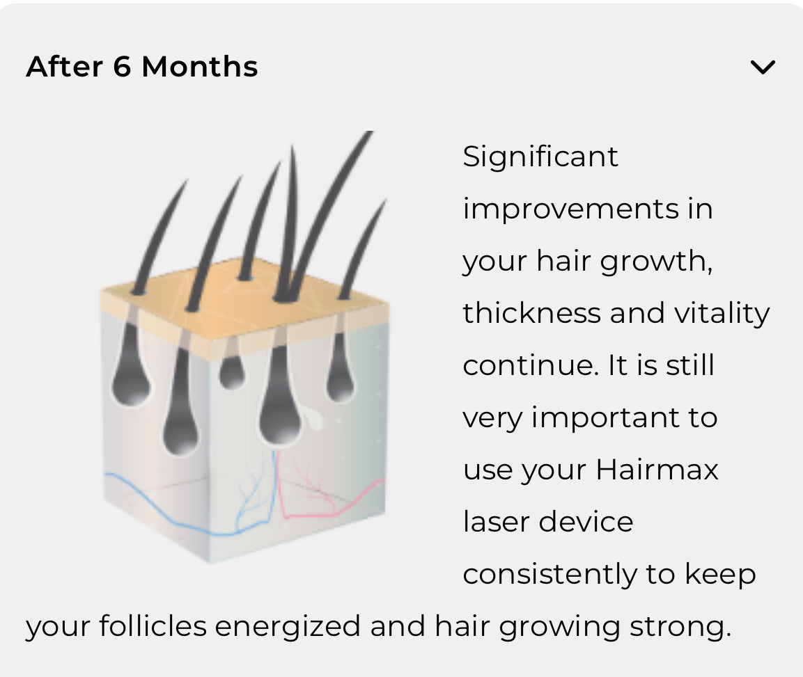 HairMax LaserBand 41 ComfortFlex Hair Growth Device